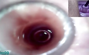 Experience Ultimate Lesbian Pleasure with Cervix Play and Peehole Fucking with a Huge Dildo