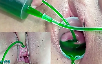 Japanese Lesbians Cervix and Pee Hole Inflation with Injections: Intimate Pleasures Unleashed